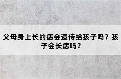 父母身上长的痣会遗传给孩子吗？孩子会长痣吗？