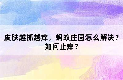 皮肤越抓越痒，蚂蚁庄园怎么解决？如何止痒？